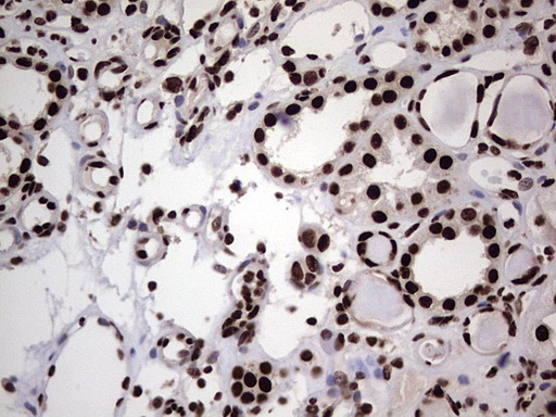 HNRNPL / hnRNP L Antibody - Immunohistochemical staining of paraffin-embedded Human Kidney tissue within the normal limits using anti-HNRNPL mouse monoclonal antibody. (Heat-induced epitope retrieval by 1 mM EDTA in 10mM Tris, pH8.5, 120C for 3min,