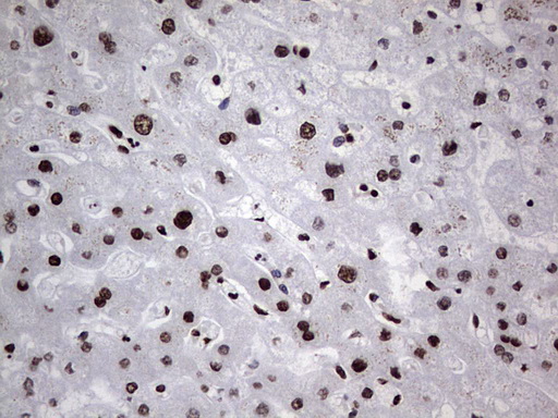 HNRNPL / hnRNP L Antibody - Immunohistochemical staining of paraffin-embedded Human liver tissue within the normal limits using anti-HNRNPL mouse monoclonal antibody. (Heat-induced epitope retrieval by 1 mM EDTA in 10mM Tris, pH8.5, 120C for 3min,