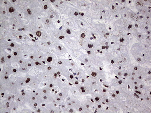 HNRNPL / hnRNP L Antibody - IHC of paraffin-embedded Human liver tissue using anti-HNRNPL mouse monoclonal antibody. (Heat-induced epitope retrieval by 1 mM EDTA in 10mM Tris, pH8.5, 120°C for 3min).