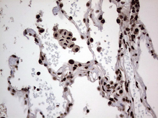 HNRNPL / hnRNP L Antibody - IHC of paraffin-embedded Human lung tissue using anti-HNRNPL mouse monoclonal antibody. (Heat-induced epitope retrieval by 1 mM EDTA in 10mM Tris, pH8.5, 120°C for 3min).