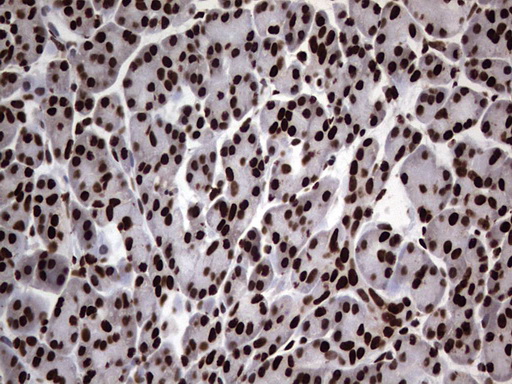 HNRNPL / hnRNP L Antibody - IHC of paraffin-embedded Human pancreas tissue using anti-HNRNPL mouse monoclonal antibody. (Heat-induced epitope retrieval by 1 mM EDTA in 10mM Tris, pH8.5, 120°C for 3min).