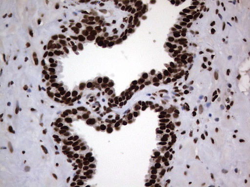 HNRNPL / hnRNP L Antibody - IHC of paraffin-embedded Human prostate tissue using anti-HNRNPL mouse monoclonal antibody. (Heat-induced epitope retrieval by 1 mM EDTA in 10mM Tris, pH8.5, 120°C for 3min).