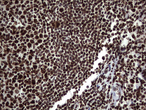 HNRNPL / hnRNP L Antibody - IHC of paraffin-embedded Human tonsil using anti-HNRNPL mouse monoclonal antibody. (Heat-induced epitope retrieval by 1 mM EDTA in 10mM Tris, pH8.5, 120°C for 3min).