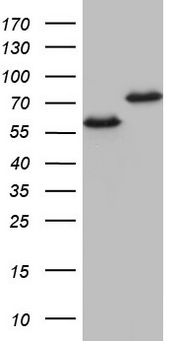 HNRNPL / hnRNP L Antibody - HEK293T cells were transfected with the pCMV6-ENTRY control. (Left lane) or pCMV6-ENTRY HNRNPL. (Right lane) cDNA for 48 hrs and lysed. Equivalent amounts of cell lysates. (5 ug per lane) were separated by SDS-PAGE and immunoblotted with anti-HNRNPL.