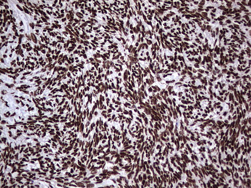 HNRNPL / hnRNP L Antibody - Immunohistochemical staining of paraffin-embedded Human Ovary tissue within the normal limits using anti-HNRNPL mouse monoclonal antibody. (Heat-induced epitope retrieval by 1 mM EDTA in 10mM Tris, pH8.5, 120C for 3min,