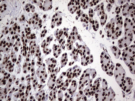 HNRNPL / hnRNP L Antibody - Immunohistochemical staining of paraffin-embedded Human pancreas tissue within the normal limits using anti-HNRNPL mouse monoclonal antibody. (Heat-induced epitope retrieval by 1 mM EDTA in 10mM Tris, pH8.5, 120C for 3min,