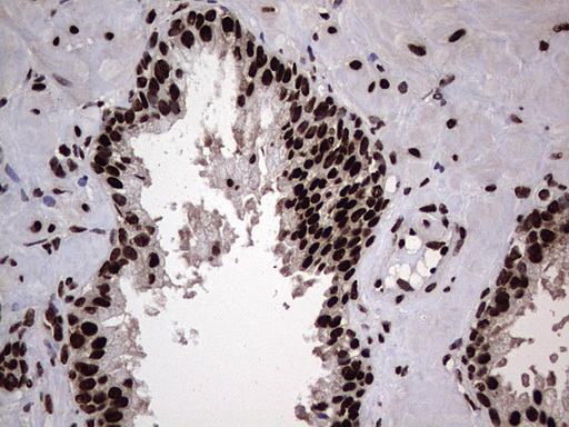 HNRNPL / hnRNP L Antibody - Immunohistochemical staining of paraffin-embedded Human prostate tissue within the normal limits using anti-HNRNPL mouse monoclonal antibody. (Heat-induced epitope retrieval by 1 mM EDTA in 10mM Tris, pH8.5, 120C for 3min,