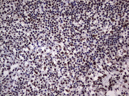 HNRNPL / hnRNP L Antibody - Immunohistochemical staining of paraffin-embedded Human tonsil within the normal limits using anti-HNRNPL mouse monoclonal antibody. (Heat-induced epitope retrieval by 1 mM EDTA in 10mM Tris, pH8.5, 120C for 3min,