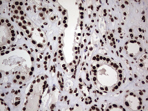 HNRNPL / hnRNP L Antibody - Immunohistochemical staining of paraffin-embedded Human Kidney tissue within the normal limits using anti-HNRNPL mouse monoclonal antibody. (Heat-induced epitope retrieval by 1 mM EDTA in 10mM Tris, pH8.5, 120C for 3min,