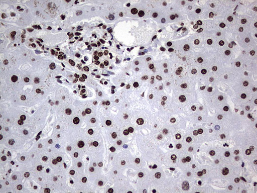 HNRNPL / hnRNP L Antibody - Immunohistochemical staining of paraffin-embedded Human liver tissue within the normal limits using anti-HNRNPL mouse monoclonal antibody. (Heat-induced epitope retrieval by 1 mM EDTA in 10mM Tris, pH8.5, 120C for 3min,