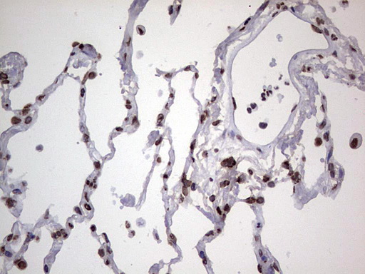 HNRNPL / hnRNP L Antibody - Immunohistochemical staining of paraffin-embedded Human lung tissue within the normal limits using anti-HNRNPL mouse monoclonal antibody. (Heat-induced epitope retrieval by 1 mM EDTA in 10mM Tris, pH8.5, 120C for 3min,