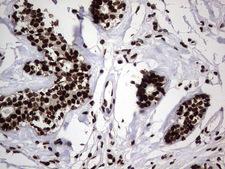 HNRNPL / hnRNP L Antibody - Immunohistochemical staining of paraffin-embedded Human breast tissue within the normal limits using anti-HNRNPL mouse monoclonal antibody. (Heat-induced epitope retrieval by 1 mM EDTA in 10mM Tris, pH8.5, 120C for 3min,
