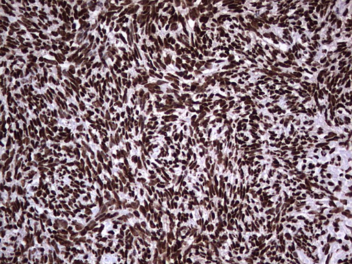 HNRNPL / hnRNP L Antibody - Immunohistochemical staining of paraffin-embedded Human Ovary tissue within the normal limits using anti-HNRNPL mouse monoclonal antibody. (Heat-induced epitope retrieval by 1 mM EDTA in 10mM Tris, pH8.5, 120C for 3min,