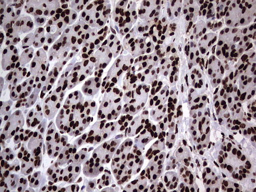 HNRNPL / hnRNP L Antibody - Immunohistochemical staining of paraffin-embedded Human pancreas tissue within the normal limits using anti-HNRNPL mouse monoclonal antibody. (Heat-induced epitope retrieval by 1 mM EDTA in 10mM Tris, pH8.5, 120C for 3min,