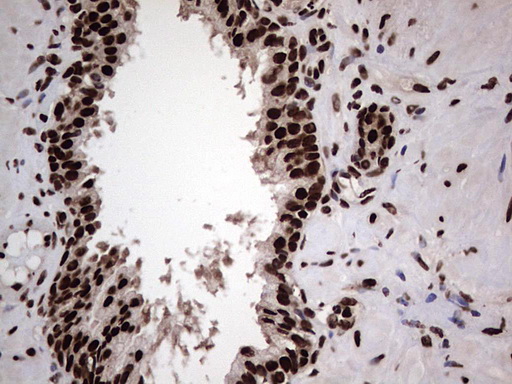 HNRNPL / hnRNP L Antibody - Immunohistochemical staining of paraffin-embedded Human prostate tissue within the normal limits using anti-HNRNPL mouse monoclonal antibody. (Heat-induced epitope retrieval by 1 mM EDTA in 10mM Tris, pH8.5, 120C for 3min,