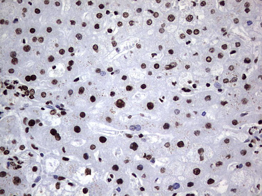 HNRNPL / hnRNP L Antibody - Immunohistochemical staining of paraffin-embedded Human liver tissue within the normal limits using anti-HNRNPL mouse monoclonal antibody. (Heat-induced epitope retrieval by 1 mM EDTA in 10mM Tris, pH8.5, 120C for 3min,