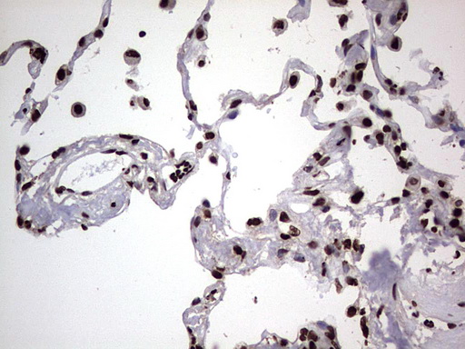 HNRNPL / hnRNP L Antibody - Immunohistochemical staining of paraffin-embedded Human lung tissue within the normal limits using anti-HNRNPL mouse monoclonal antibody. (Heat-induced epitope retrieval by 1 mM EDTA in 10mM Tris, pH8.5, 120C for 3min,