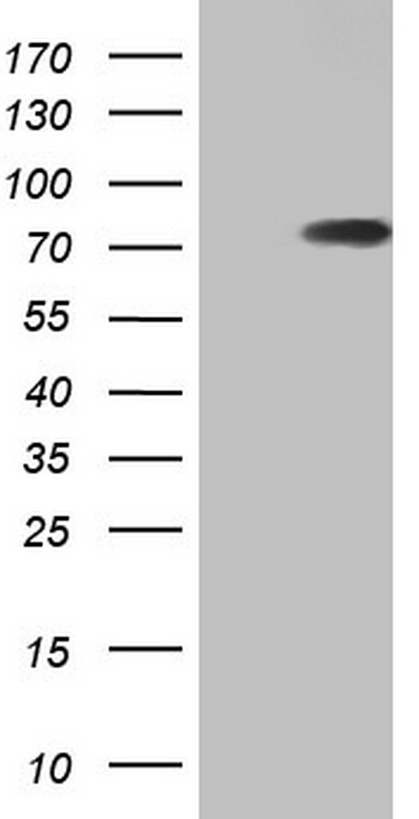 HNRNPL / hnRNP L Antibody - HEK293T cells were transfected with the pCMV6-ENTRY control (Left lane) or pCMV6-ENTRY HNRNPL (Right lane) cDNA for 48 hrs and lysed. Equivalent amounts of cell lysates (5 ug per lane) were separated by SDS-PAGE and immunoblotted with anti-HNRNPL.