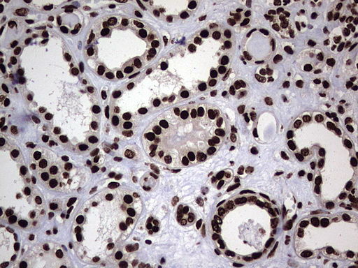 HNRNPL / hnRNP L Antibody - IHC of paraffin-embedded Human Kidney tissue using anti-HNRNPL mouse monoclonal antibody. (Heat-induced epitope retrieval by 1 mM EDTA in 10mM Tris, pH8.5, 120°C for 3min).