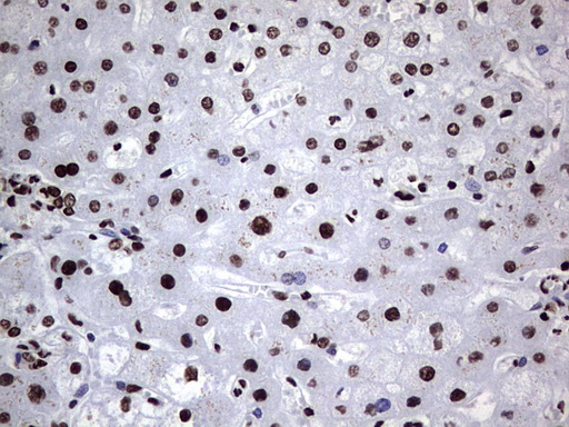 HNRNPL / hnRNP L Antibody - IHC of paraffin-embedded Human liver tissue using anti-HNRNPL mouse monoclonal antibody. (Heat-induced epitope retrieval by 1 mM EDTA in 10mM Tris, pH8.5, 120°C for 3min).