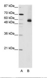 HNRNPL / hnRNP L Antibody - A: Marker, B: HepG2 Cell Lysate.  This image was taken for the unconjugated form of this product. Other forms have not been tested.