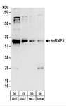 HNRNPL / hnRNP L Antibody - Detection of Human hnRNP-L by Western Blot. Samples: Whole cell lysate from 293T (15 and 50 ug), HeLa (50 ug), and Jurkat (50 ug) cells. Antibodies: Affinity purified rabbit anti-hnRNP-L antibody used for WB at 0.1 ug/ml. Detection: Chemiluminescence with an exposure time of 30 seconds.