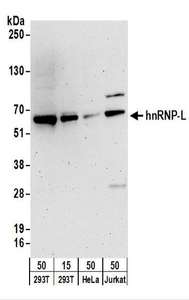 HNRNPL / hnRNP L Antibody - Detection of Human hnRNP-L by Western Blot. Samples: Whole cell lysate from 293T (15 and 50 ug), HeLa (50 ug), and Jurkat (50 ug) cells. Antibodies: Affinity purified rabbit anti-hnRNP-L antibody used for WB at 0.1 ug/ml. Detection: Chemiluminescence with an exposure time of 3 minutes.