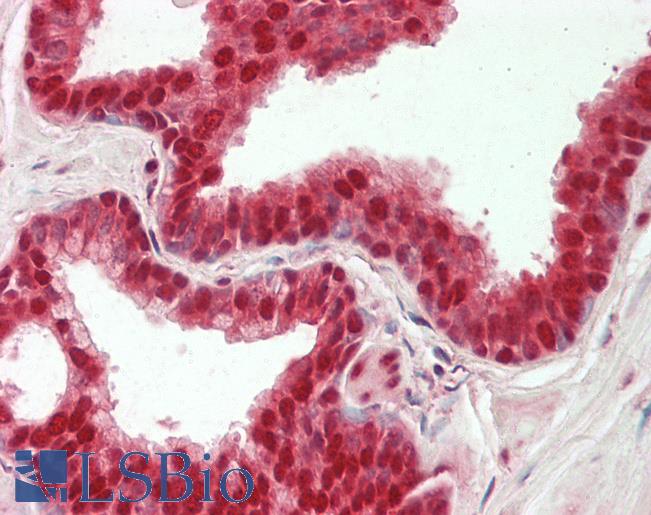 HNRNPL / hnRNP L Antibody - Human Prostate: Formalin-Fixed, Paraffin-Embedded (FFPE).  This image was taken for the unconjugated form of this product. Other forms have not been tested.