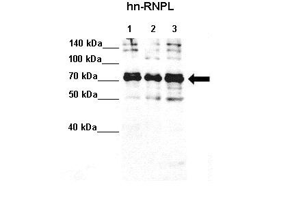 HNRNPL / hnRNP L Antibody - Western blot analysis using   Anti-HNRNPL / hnRNP L Antibody (aa82-131) at 1:4000 dilution (20ug loaded per lane). Lane 1: Hela S3 lysate. Lane 2: MCF7 lysate. Lane 3: K562 lysate..  This image was taken for the unconjugated form of this product. Other forms have not been tested.