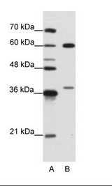 HNRNPL / hnRNP L Antibody - A: Marker, B: Jurkat Cell Lysate.  This image was taken for the unconjugated form of this product. Other forms have not been tested.
