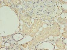 HNRNPL / hnRNP L Antibody - Immunohistochemistry of paraffin-embedded human kidney using antibody at 1:100 dilution.  This image was taken for the unconjugated form of this product. Other forms have not been tested.