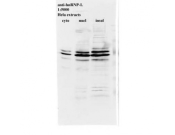 HNRNPL / hnRNP L Antibody - Western blot of HNRNPL antibody.