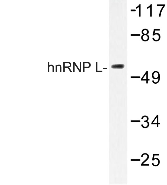HNRNPL / hnRNP L Antibody - Western blot of hnRNP L (G58) pAb in extracts from HeLa cells.