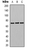 HNRNPL / hnRNP L Antibody - Western blot analysis of hnRNP L expression in HUVEC (A); HepG2 (B); NIH3T3 (C) whole cell lysates.