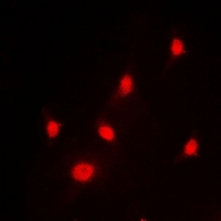 HNRNPL / hnRNP L Antibody - Immunofluorescent analysis of hnRNP L staining in HeLa cells. Formalin-fixed cells were permeabilized with 0.1% Triton X-100 in TBS for 5-10 minutes and blocked with 3% BSA-PBS for 30 minutes at room temperature. Cells were probed with the primary antibody in 3% BSA-PBS and incubated overnight at 4 deg C in a humidified chamber. Cells were washed with PBST and incubated with a DyLight 594-conjugated secondary antibody (red) in PBS at room temperature in the dark. DAPI was used to stain the cell nuclei (blue).