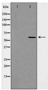 HNRNPL / hnRNP L Antibody - Western blot of hnRNP L expression in Jurkat cells
