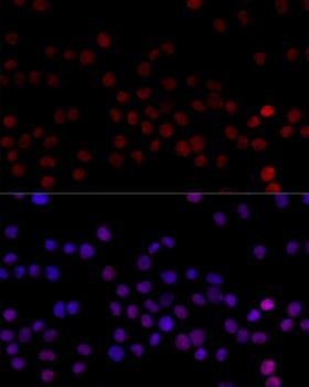 HNRNPL / hnRNP L Antibody - Immunofluorescence analysis of 293T cells using HNRNPL antibody at dilution of 1:100 (40x lens). Blue: DAPI for nuclear staining.