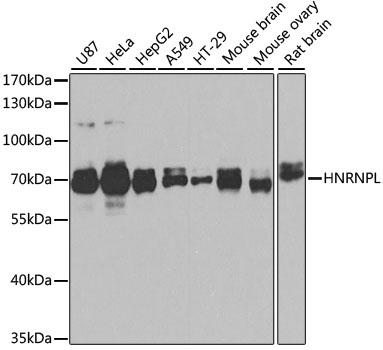HNRNPL / hnRNP L Antibody - Western blot analysis of extracts of various cell lines, using HNRNPL antibody at 1:1000 dilution. The secondary antibody used was an HRP Goat Anti-Rabbit IgG (H+L) at 1:10000 dilution. Lysates were loaded 25ug per lane and 3% nonfat dry milk in TBST was used for blocking. An ECL Kit was used for detection and the exposure time was 90s.