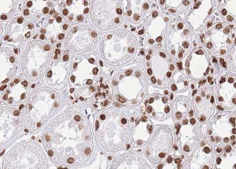 HNRNPL / hnRNP L Antibody - 1:100 staining human kidney tissue by IHC-P. The tissue was formaldehyde fixed and a heat mediated antigen retrieval step in citrate buffer was performed. The tissue was then blocked and incubated with the antibody for 1.5 hours at 22°C. An HRP conjugated goat anti-rabbit antibody was used as the secondary.