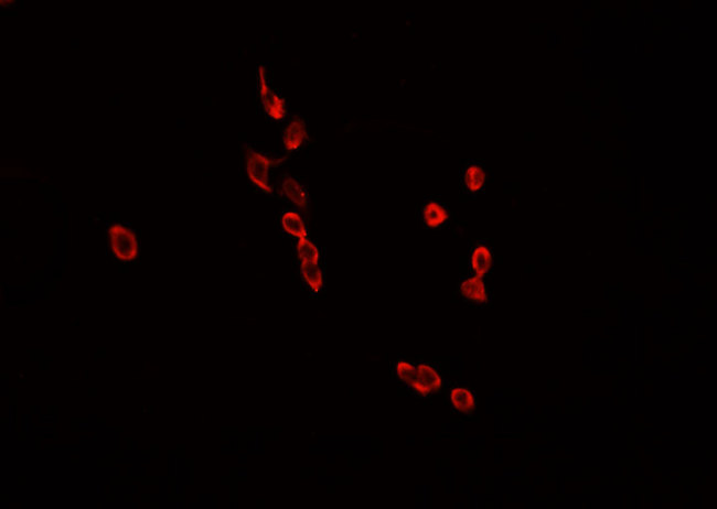 HNRNPL / hnRNP L Antibody - Staining HeLa cells by IF/ICC. The samples were fixed with PFA and permeabilized in 0.1% Triton X-100, then blocked in 10% serum for 45 min at 25°C. The primary antibody was diluted at 1:200 and incubated with the sample for 1 hour at 37°C. An Alexa Fluor 594 conjugated goat anti-rabbit IgG (H+L) Ab, diluted at 1/600, was used as the secondary antibody.