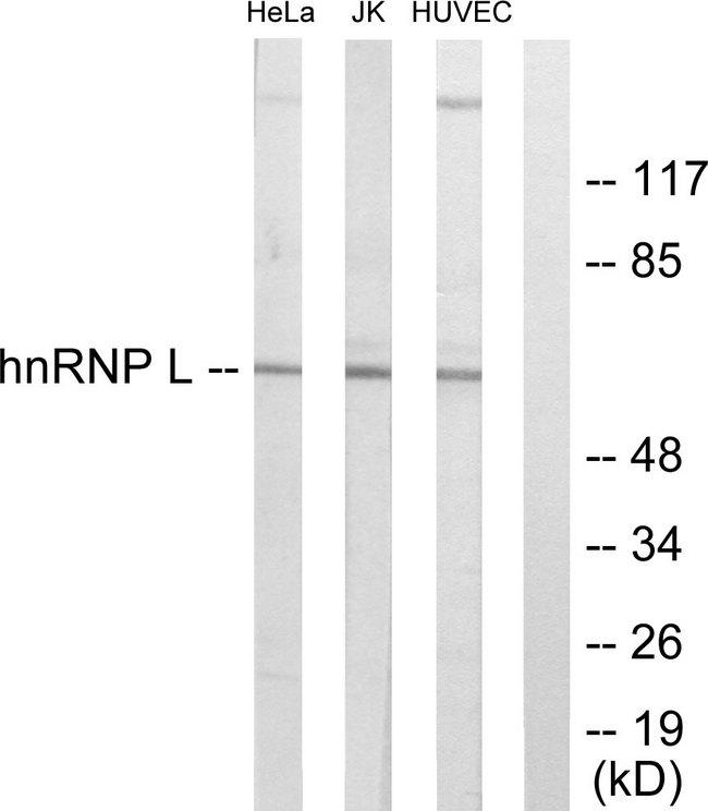 HNRNPL / hnRNP L Antibody - Western blot analysis of extracts from HeLa cells, Jurkat cells and HUVEC cells, using hnRNP L antibody.