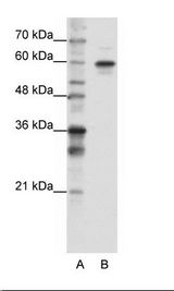 HnRNPLL / HNRPLL Antibody - A: Marker, B: HepG2 Cell Lysate.  This image was taken for the unconjugated form of this product. Other forms have not been tested.