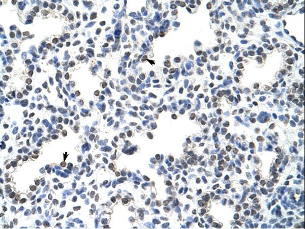 HnRNPLL / HNRPLL Antibody - HNRPLL antibody ARP41102_T100-NP_612403-HNRPLL (heterogeneous nuclear ribonucleoprotein L-like) Antibody was used in IHC to stain formalin-fixed, paraffin-embedded human lung.  This image was taken for the unconjugated form of this product. Other forms have not been tested.