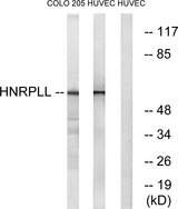 HnRNPLL / HNRPLL Antibody - Western blot analysis of lysates from HUVEC and COLO cells, using HNRPLL Antibody. The lane on the right is blocked with the synthesized peptide.