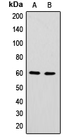HnRNPLL / HNRPLL Antibody - Western blot analysis of hnRNP LL expression in HepG2 (A); K562 (B) whole cell lysates.