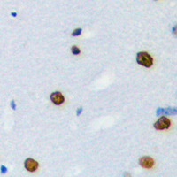HnRNPLL / HNRPLL Antibody - Immunohistochemical analysis of hnRNP LL staining in human brain formalin fixed paraffin embedded tissue section. The section was pre-treated using heat mediated antigen retrieval with sodium citrate buffer (pH 6.0). The section was then incubated with the antibody at room temperature and detected using an HRP conjugated compact polymer system. DAB was used as the chromogen. The section was then counterstained with hematoxylin and mounted with DPX.