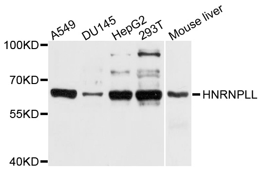 HnRNPLL / HNRPLL Antibody - Western blot analysis of extracts of various cell lines, using HNRNPLL antibody at 1:1000 dilution. The secondary antibody used was an HRP Goat Anti-Rabbit IgG (H+L) at 1:10000 dilution. Lysates were loaded 25ug per lane and 3% nonfat dry milk in TBST was used for blocking. An ECL Kit was used for detection and the exposure time was 30s.
