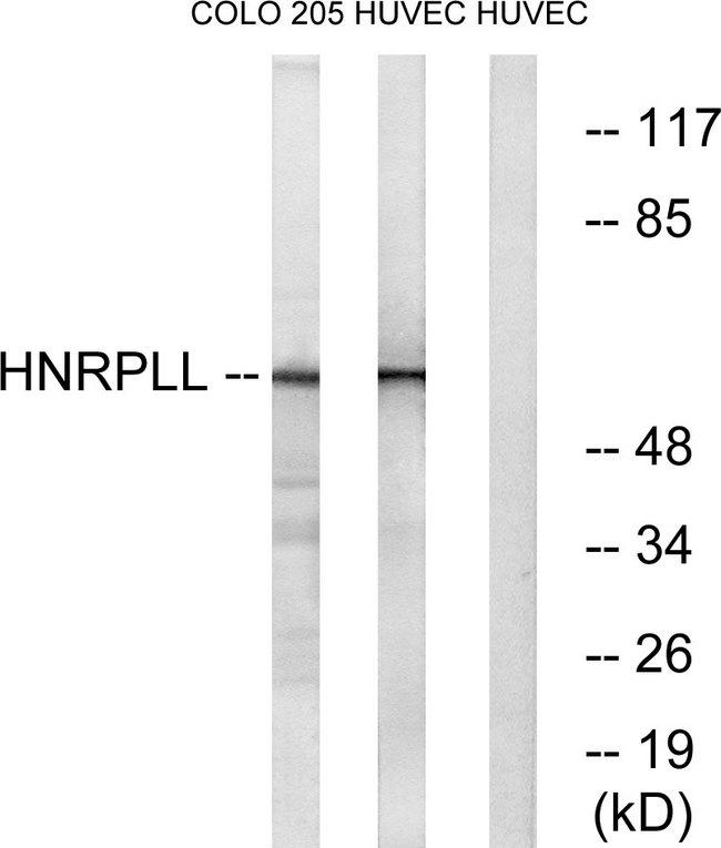 HnRNPLL / HNRPLL Antibody - Western blot analysis of extracts from COLO cells and HUVEC cells, using HNRPLL antibody.