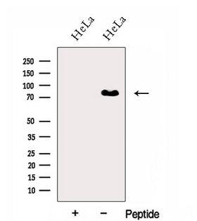 HNRNPR / hnRNP R Antibody - Western blot analysis of extracts of HeLa cells using HNRNPR antibody. The lane on the left was treated with blocking peptide.