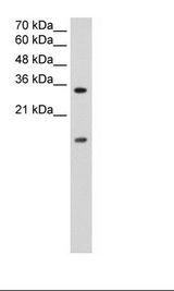 HNRNPUL1 Antibody - Jurkat Cell Lysate.  This image was taken for the unconjugated form of this product. Other forms have not been tested.